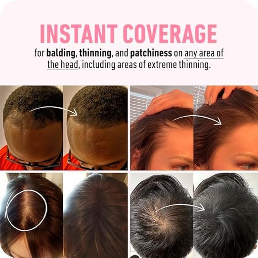 Hairline Powder Instant Hair Root Touch Up Hair Powder, Hair Topper for Women and Men