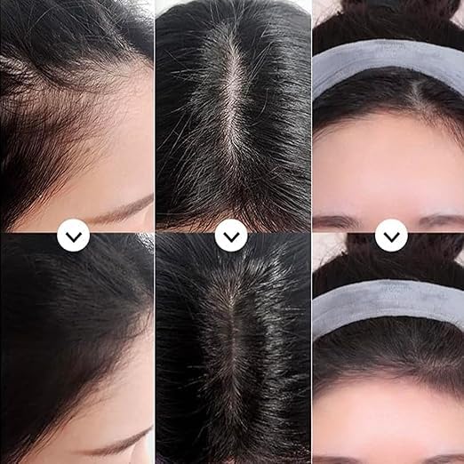 Hairline Powder Instant Hair Root Touch Up Hair Powder, Hair Topper for Women and Men