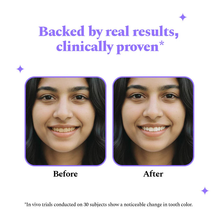 Purple Magic Teeth Whitening Strips